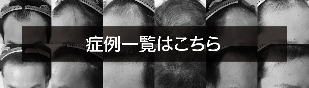 症例一覧はこちら