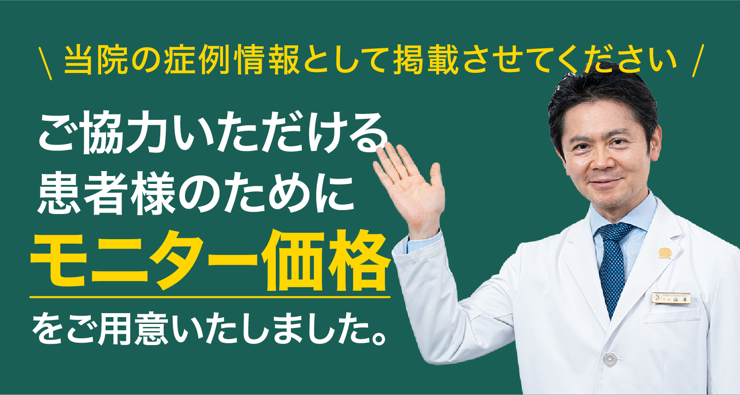 当院の活動にご協力いただける方にモニタープランにて施術をご提供いたします。