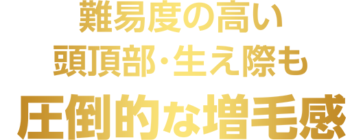 難易度の高い頭頂部･生え際も圧倒的な増毛感