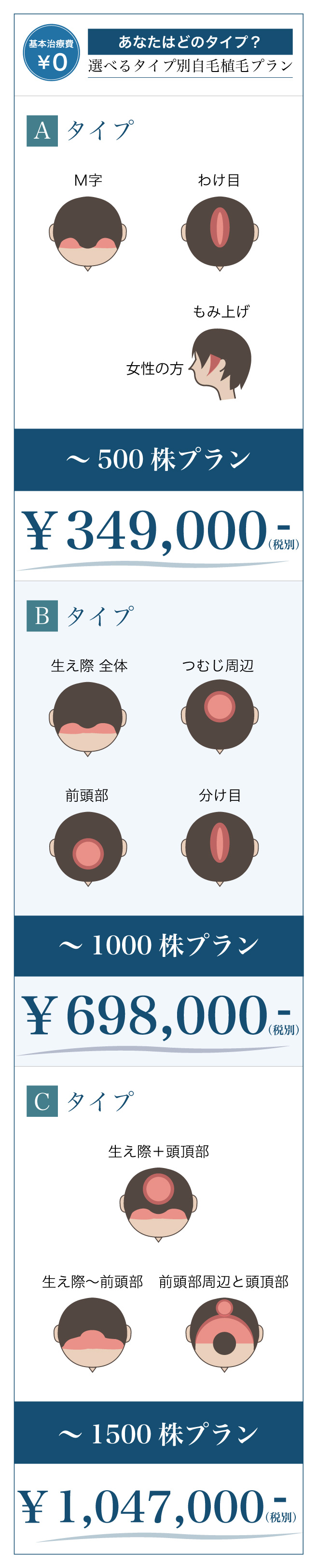 選べる植毛プラン