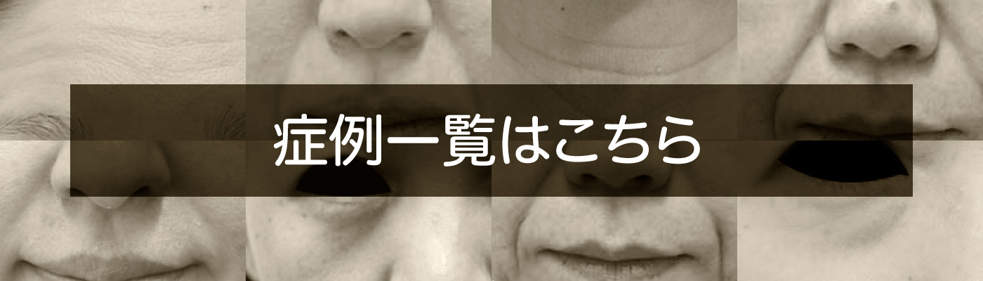 肌細胞治療モニター募集