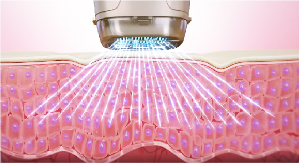 プラズマエネルギーをお肌に照射