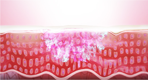 開いた経路に有効成分が効率良く行き渡ります。『経皮ドラッグデリバリーシステム』