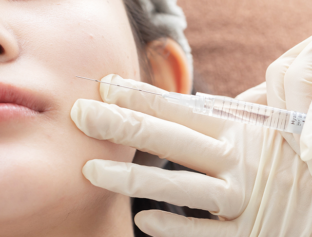 ヒアルロン酸注射