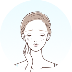 しみ・そばかす