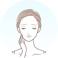 ニキビ・ニキビ跡