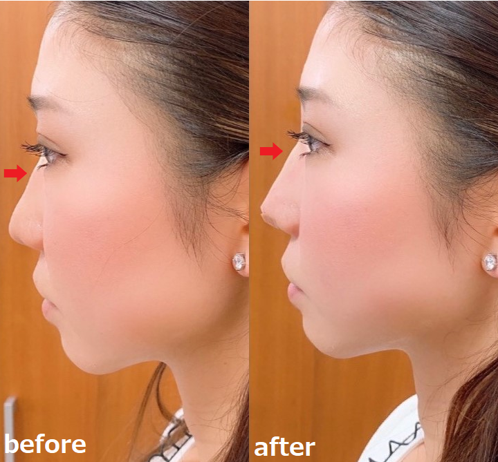 Gメッシュについて