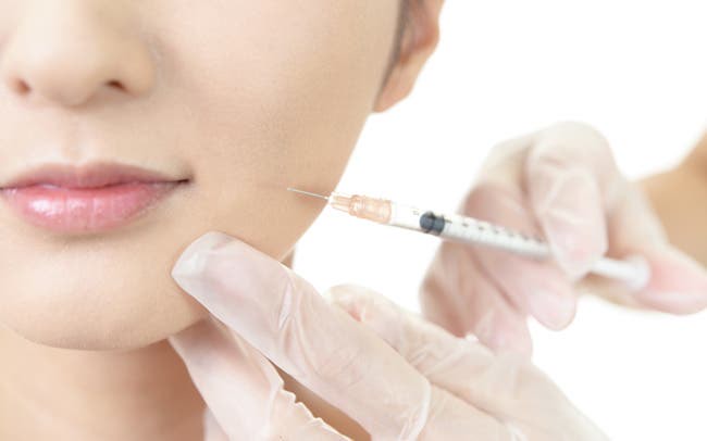 ボトックスについて