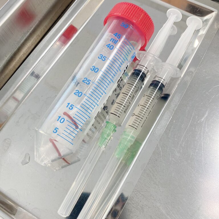 真皮線維芽細胞補充療法について