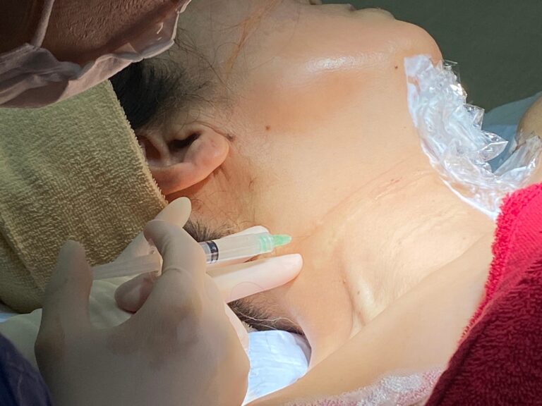 真皮線維芽補充療法について②