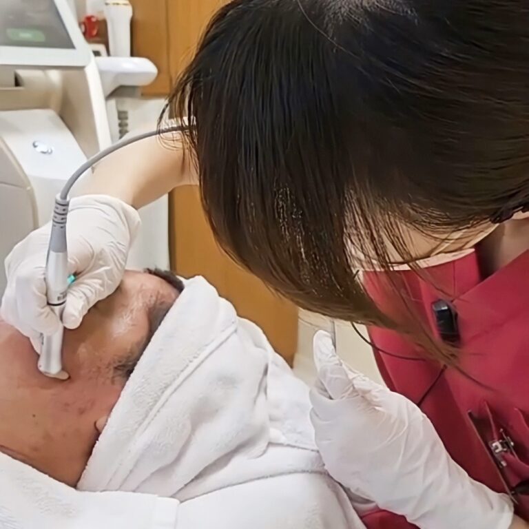 アクネスニードル～繰り返さないニキビ治療～