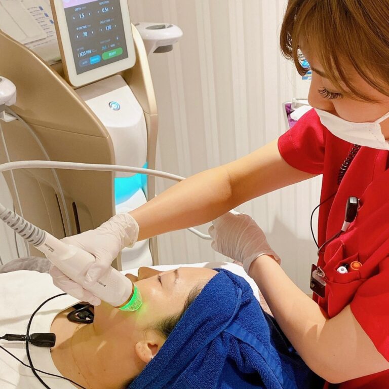 RFフラクショナルマイクロニードル