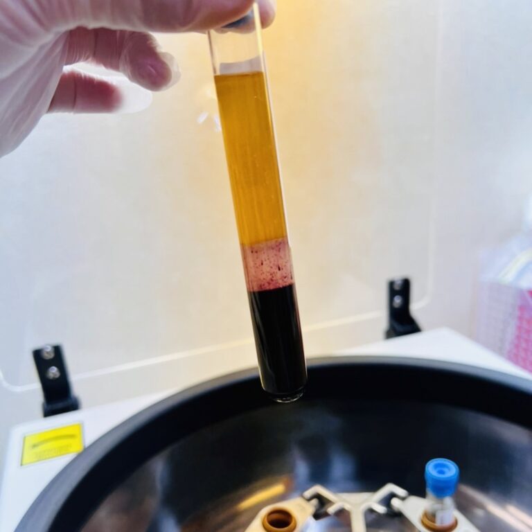 手軽にお受け頂ける再生医療『PRP療法』