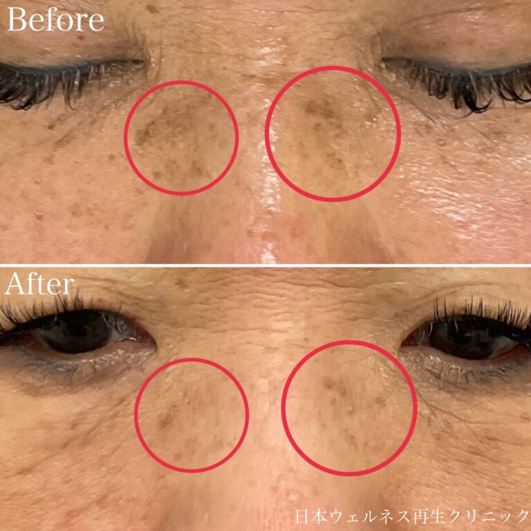 フォトRF～症例写真～