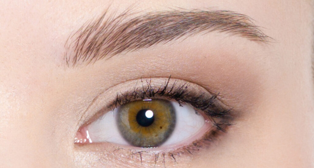 二重まぶた（埋没法）