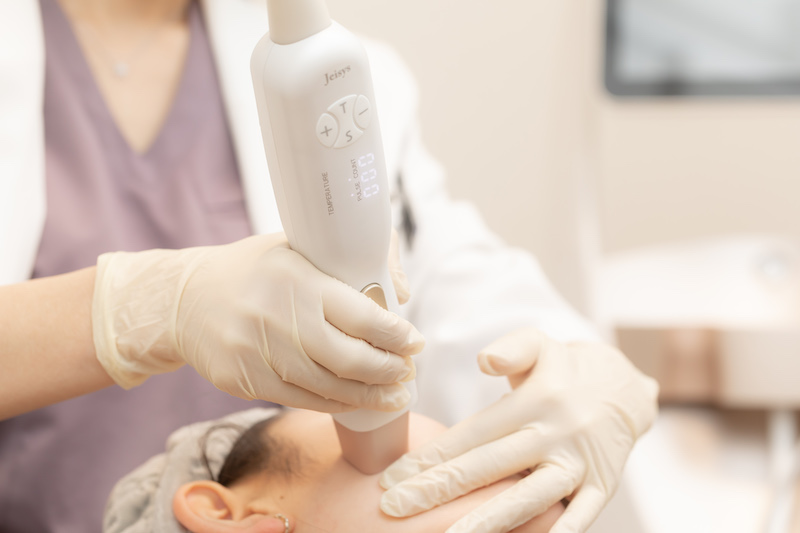 スレッドリフト＋デンシティ